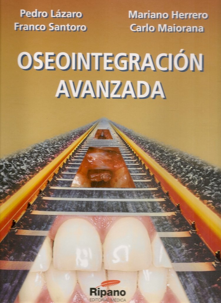 Oseointegraci�n Avanzada
