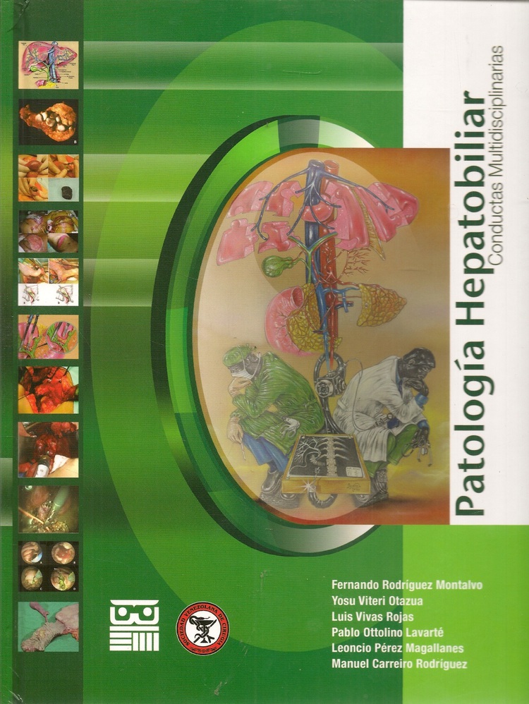 Patologa Hepatobiliar