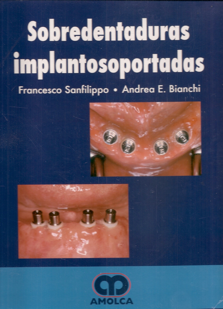 Sobredentaduras Implantosoportadas
