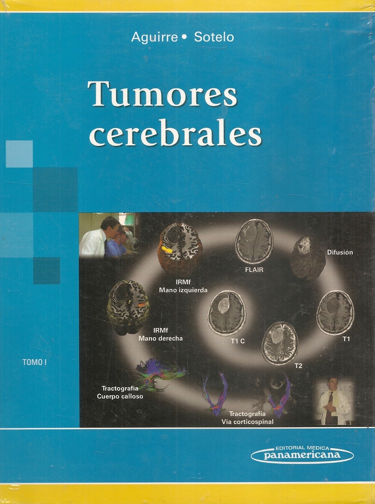 Tumores Cerebrales - Tomo 1