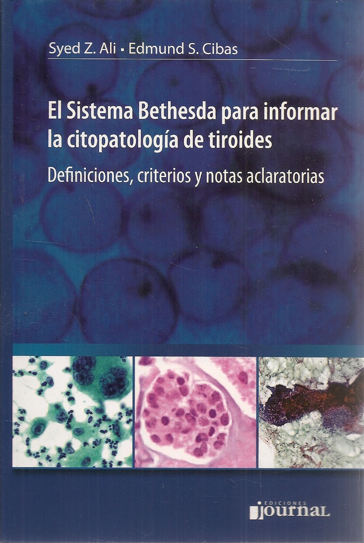 El sistema Bethesda para informar la citopatolog�a de tiroides