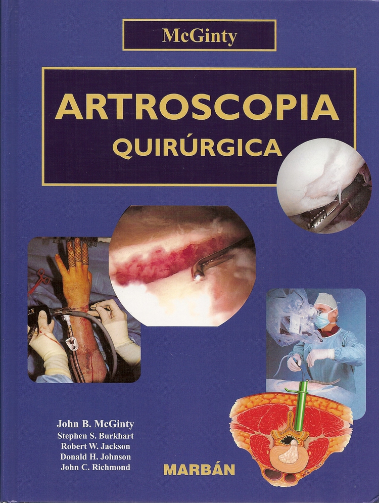 Artroscopa quirrgica