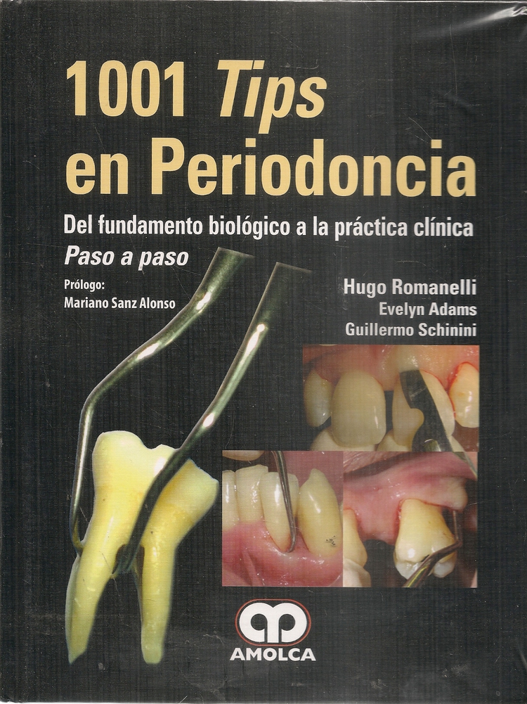 1001 Tips en Periodoncia