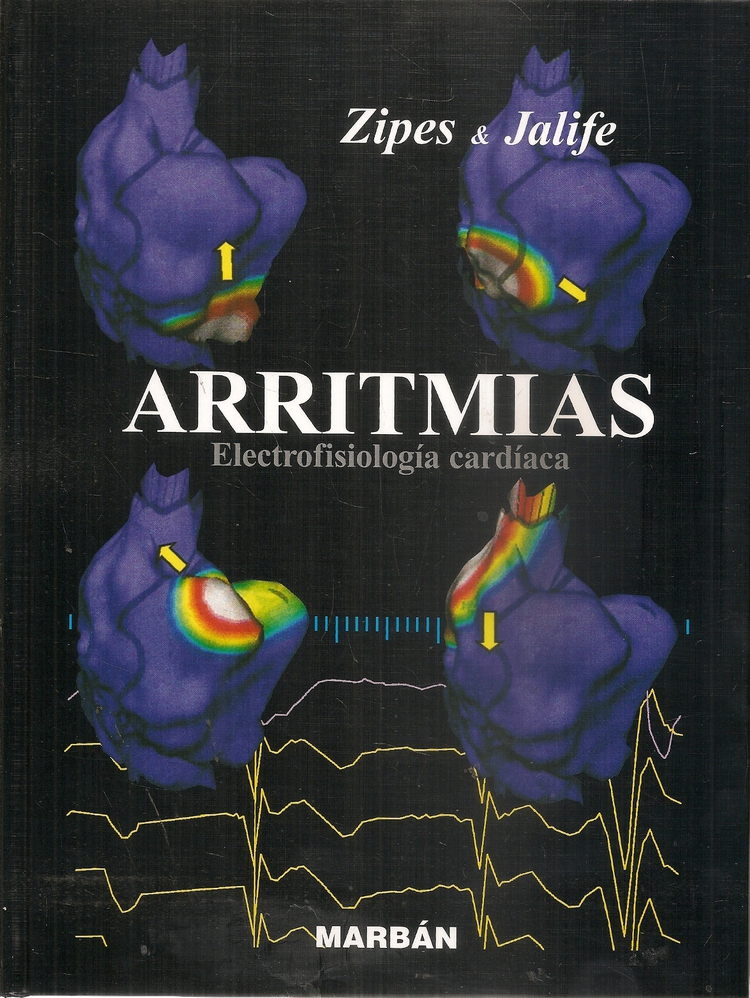 Arritmias Electrofisiologa cardaca Zipes & Jalife