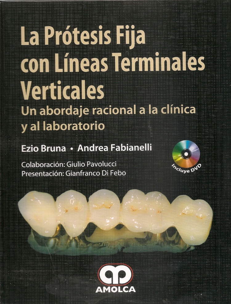 La Prtesis Fija con Lneas Terminales Verticales