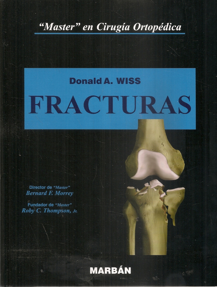Fracturas