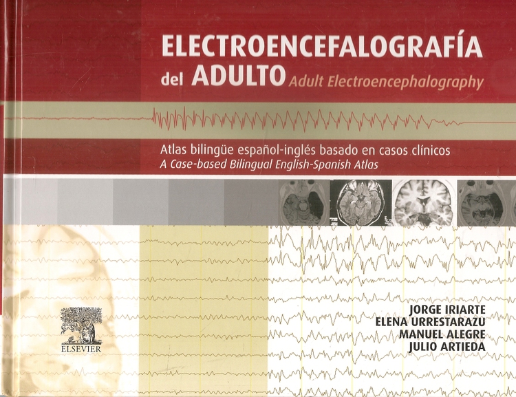 Electroencefalografa del Adulto