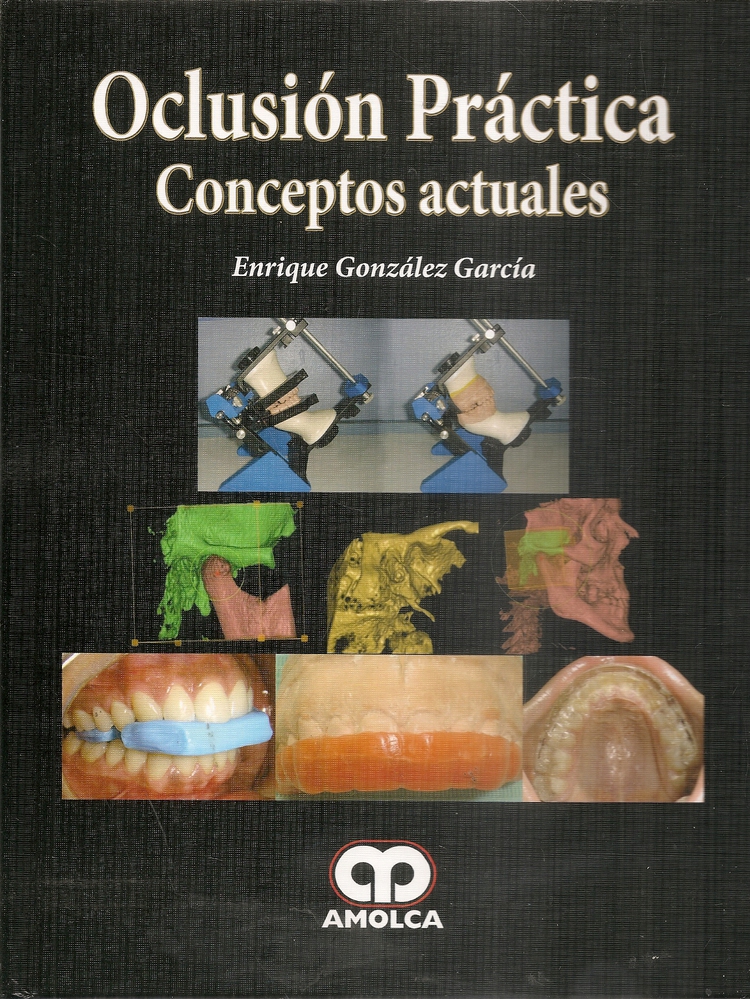 Oclusi�n Pr�ctica