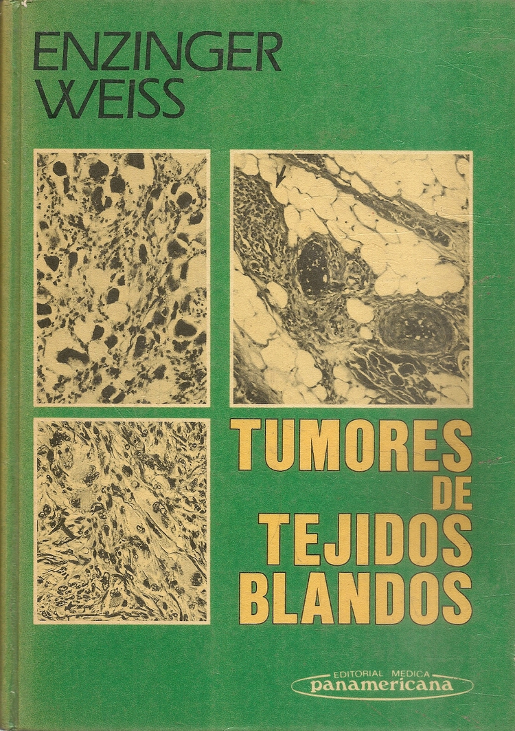 Tumores de tejidos blandos