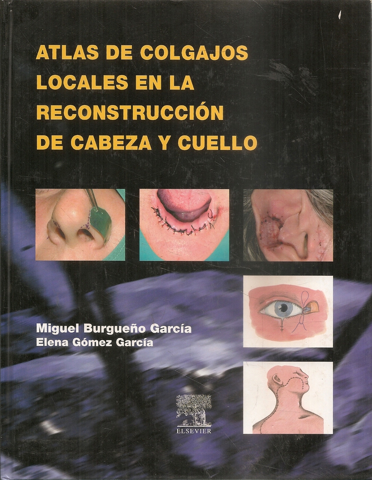 Atlas de Colgajos Locales en la Reconstrucci�n de Cabeza y Cuello