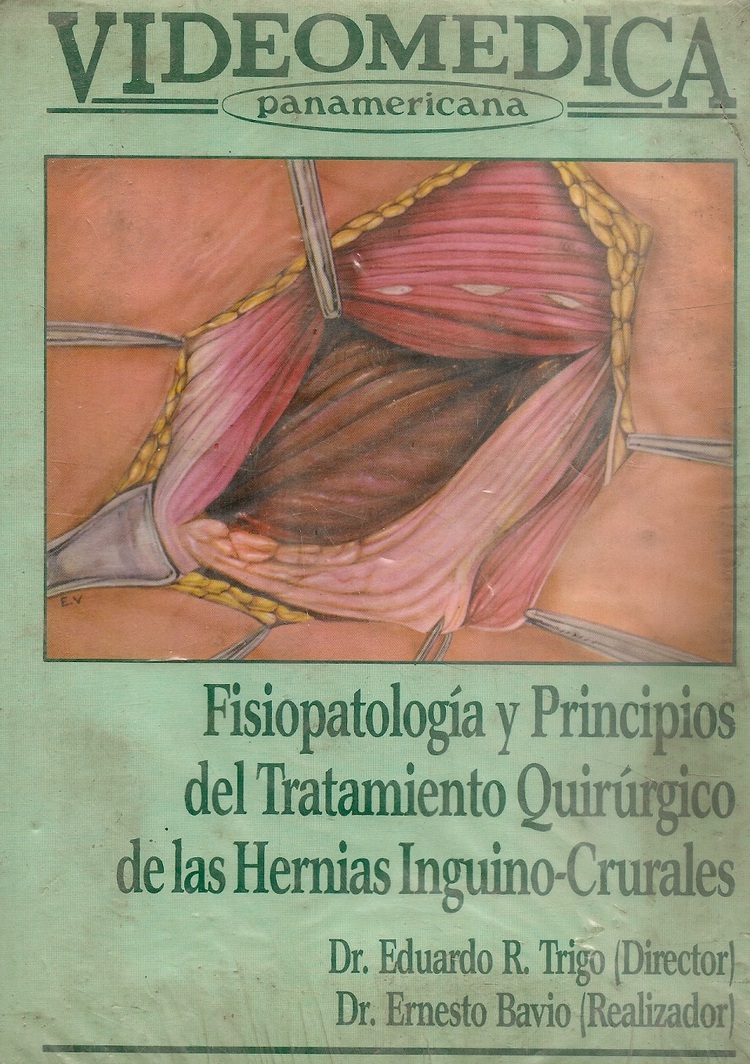 VIDEO Fisiopatologia y principios del tratamiento quirurgico de las hernias inguino-crurales -VIDEO-