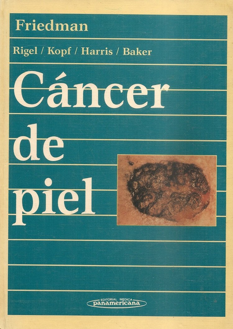 C�ncer de piel