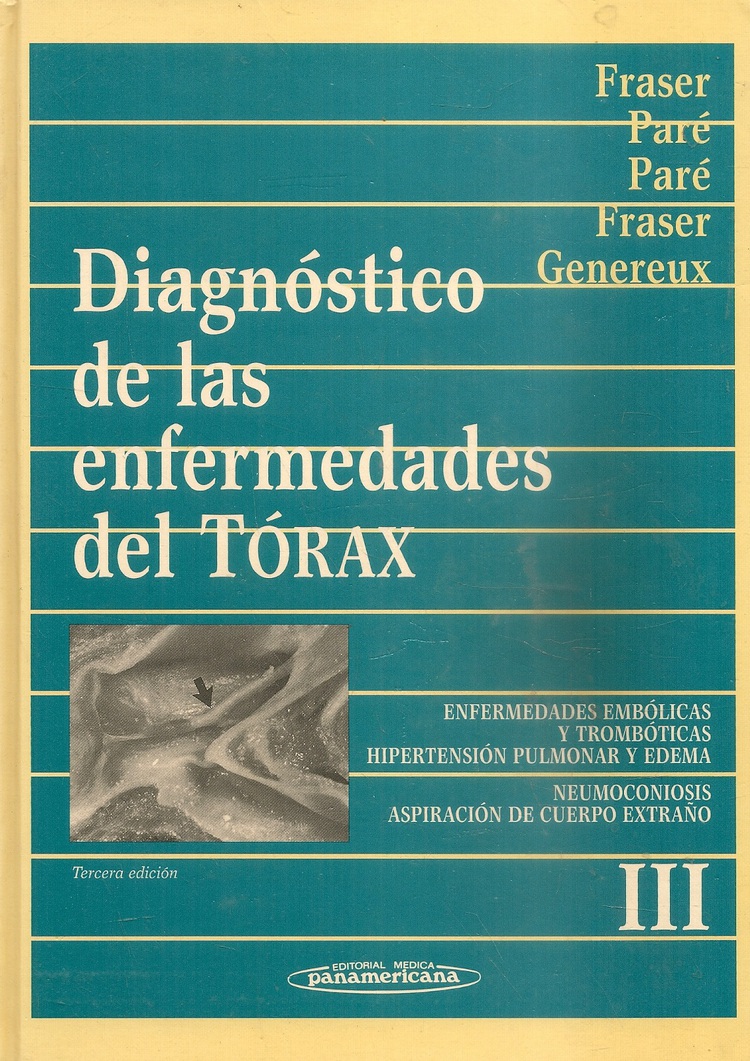 Diagnostico de las enfermedades del torax : enfermedades embolicas y tromboticas : hipertension...
