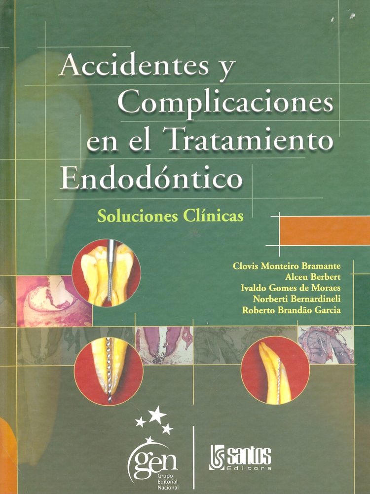 Accidentes y Complicaciones en el Tratamiento Endodntico