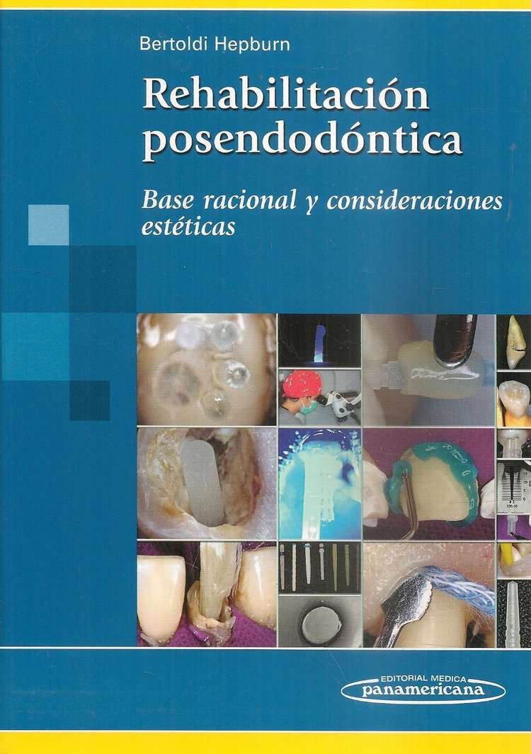Rehabilitaci�n posendod�ntica