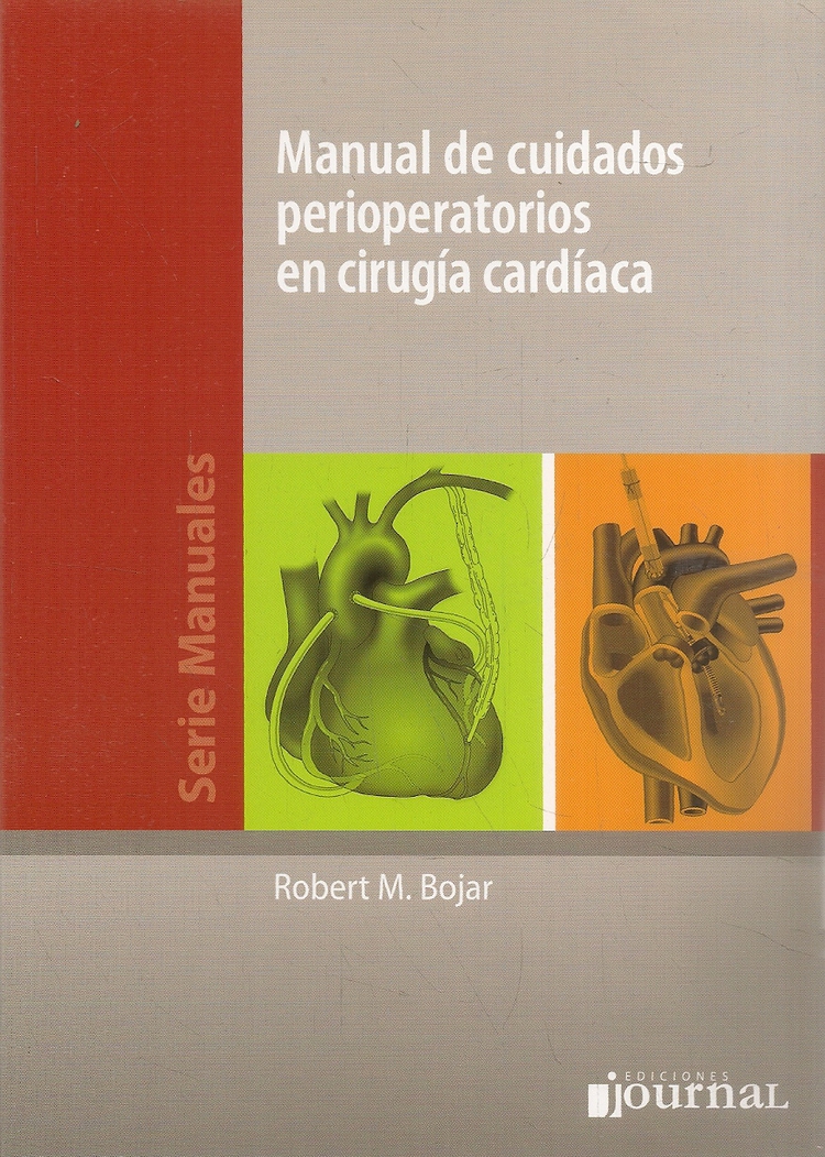 Manual de cuidados perioperatorios en cirug�a cardiaca