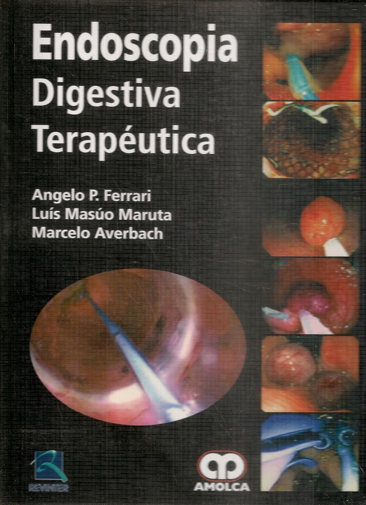 Endoscopia Digestiva Terap�utica