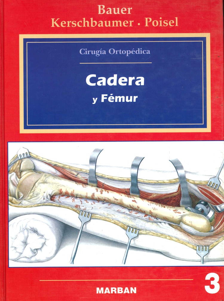 Cadera y Fmur - Volumen 3