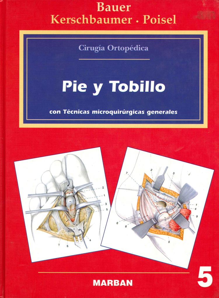 Pie y tobillo con Tcnicas microquirrgicas generales - Volumen 5