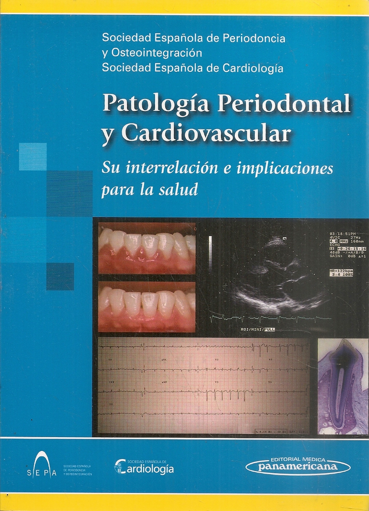 Patolog�a Periodontal y Cardiovascular