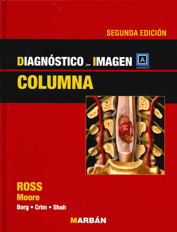 Diagn�stico por Imagen Columna