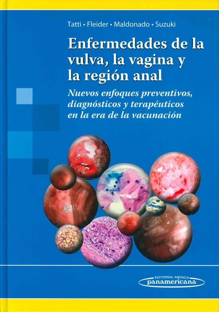 Enfermedades de la Vulva, la Vagina y la Regi�n Anal