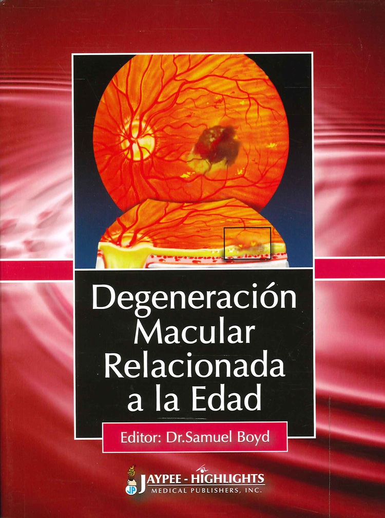 Degeneracin Macular Relacionada a la Edad