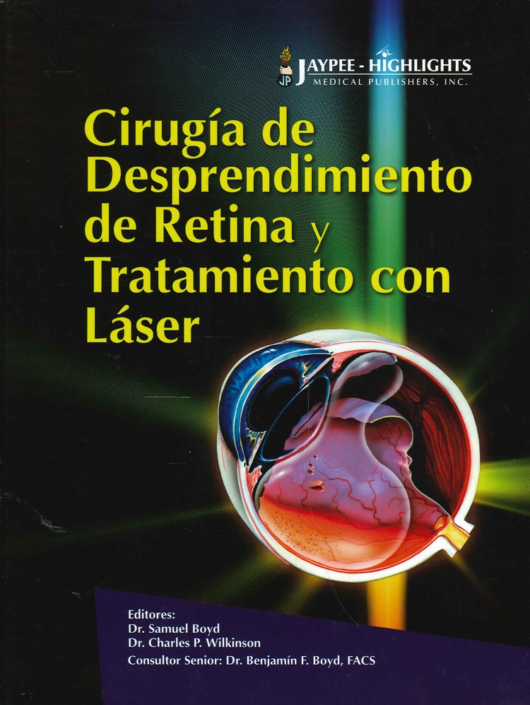 Ciruga de Desprendimiento de Retina y Tratamiento con Lser