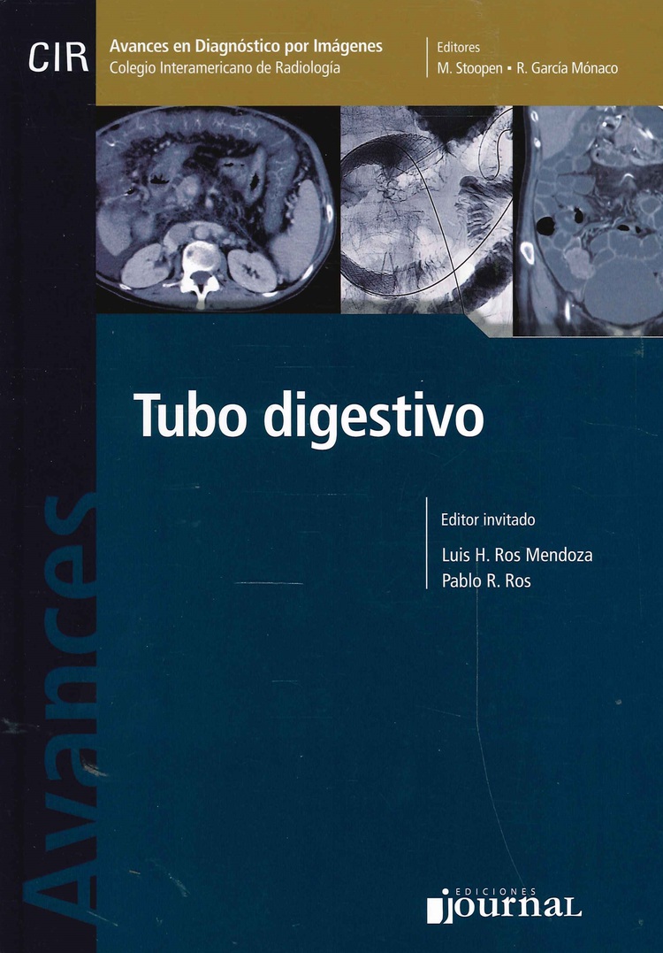 Tubo Digestivo
