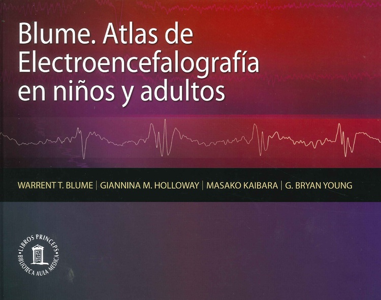 Atlas de electroencefalografa en nios y adultos